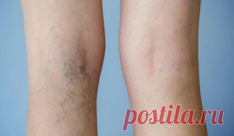 15 заболеваний, при которых помогают аппликации с поваренной солью