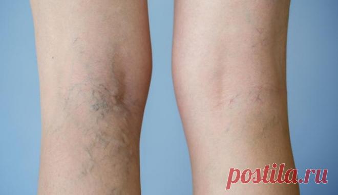 15 заболеваний, при которых помогают аппликации с поваренной солью