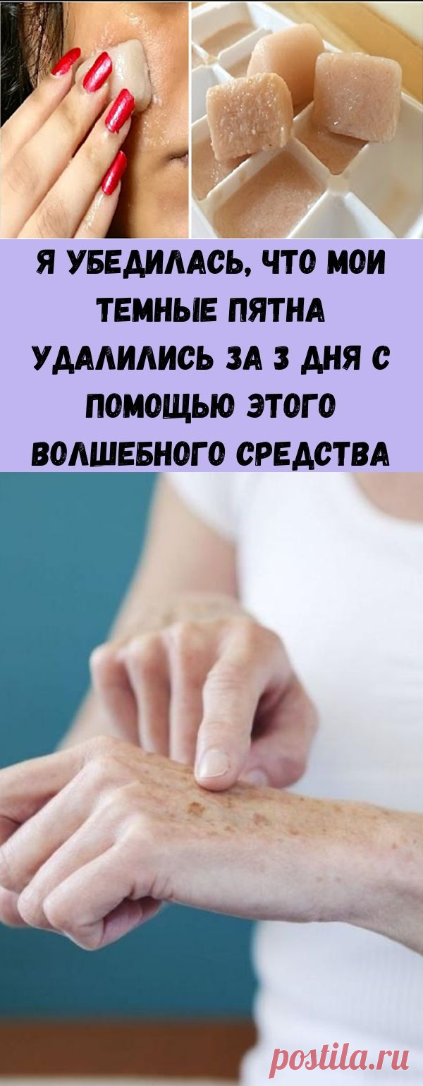Я убедилась, что мои темные пятна удалились за 3 дня с помощью этого волшебного средства - Полезные советы красоты