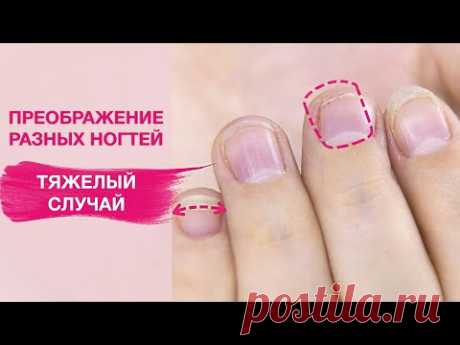 Я такого еще не встречала! | Случай просто жесть. Преображение