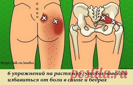 6 упражнений на растяжку, чтобы навсегда избавиться от боли в спине и бедрах