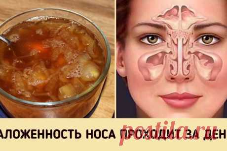Супер-средство от заложенного носа. Будете свободно дышать уже на утро! Осенне-зимний период — самое время простудных заболеваний. Даже если у вас отличный иммунитет, от этого недуга никто не застрахован. Особенно, если вы много работаете с людьми и ездите в общественном транспорте.

У вас заложен нос и сложно дышать? Постоянно ощущаете дискомфорт, а ночной сон превра