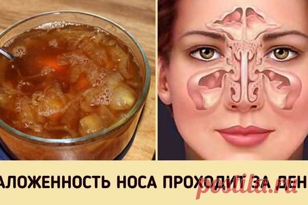 Супер-средство от заложенного носа. Будете свободно дышать уже на утро! | Краше Всех Осенне-зимний период — самое время простудных заболеваний. Даже если у вас отличный иммунитет, от этого недуга никто не застрахован. Особенно, если вы много работаете с людьми и ездите в общественном транспорте. У вас заложен нос и сложно дышать? Постоянно ощущаете дискомфорт, а ночной сон превратился в кошмар? К счастью, есть одно проверенное народное средство, которое лечит насморк за но...