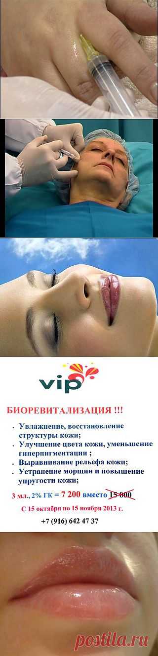 Биоревитализация
Мезотерапия
Контурная пластика лица:
- Моделирование губ и зоны вокруг них;
- Коррекция носогубных складок;
Комплексные, разновозрастные программы омоложения.