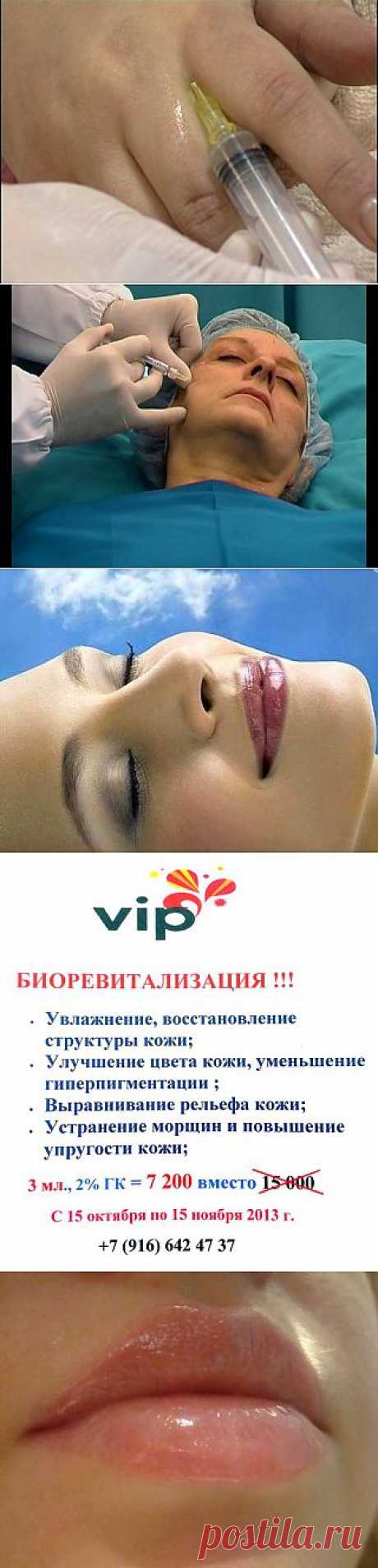 Биоревитализация
Мезотерапия
Контурная пластика лица:
- Моделирование губ и зоны вокруг них;
- Коррекция носогубных складок;
Комплексные, разновозрастные программы омоложения.