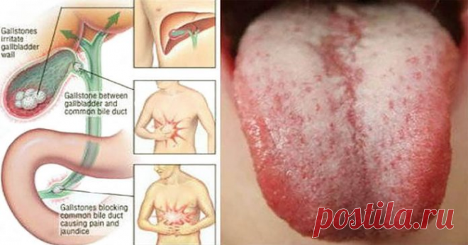 Детоксифицируйте ваш организм немедленно, если вы удивите один из этих предупреждающих знаков