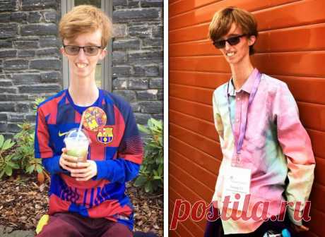 18-летний британец с редким заболеванием вдохновляет своим жизнелюбием