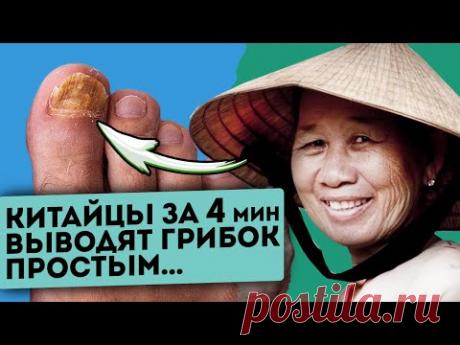 Грибок растаял на глазах! Окунул, подержал 4 мин, вытер и вот ногти как в 20 и запах испарился...