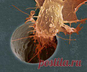 Как предотвратить рак - советы онколога - СОСЕД-ДОМОСЕД