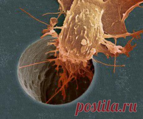 Как предотвратить рак - советы онколога - СОСЕД-ДОМОСЕД