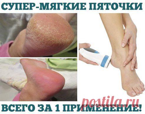 Юху! Теперь мои пяточки мягкие и шелковистые всегда. Рассказываю: что я только с ними не делала: и ванночки, и мази...ну ничего не помогало. И тут подружка посоветовала сайтик, где я купила этот чудо-прибор. Очень дешевый, но очень эффективный! Действует сразу.
Заказать можно тут - freeloom.ru/pyatki2