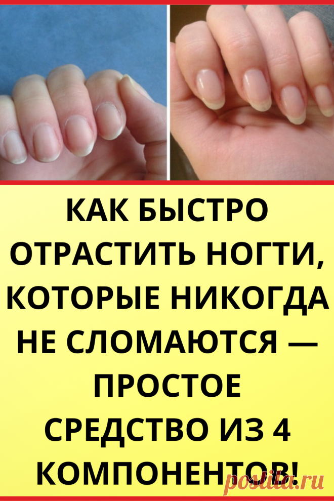 Как быстро отрастить ногти, которые никогда не сломаются — простое средство из 4 компонентов!