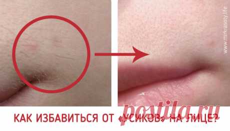 Как избавиться от «усиков» на лице?  Растительность над верхней губой у женщин — деликатная и довольно неприятная проблема. Как правило, причиной появления таких «усиков» является повышенный уровень тестостерона в организме (что, кстати…