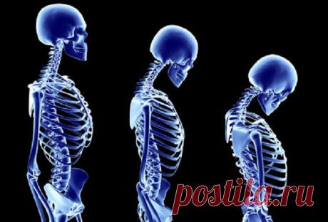 На минеральную плотность костной ткани влияет общая удовлетворенность жизнью | Образовательная программа: компендиум здоровья.