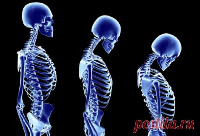 На минеральную плотность костной ткани влияет общая удовлетворенность жизнью | Образовательная программа: компендиум здоровья.