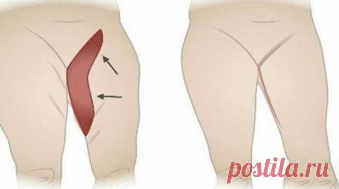 Лучшие упражнения, чтобы убрать жировые отложения с внутренней поверхности бедра! В домашних условиях! Избыточные жировые отложения могут очень раздражать и разочаровывать, особенно когда он находится на «интимных» частях тела,