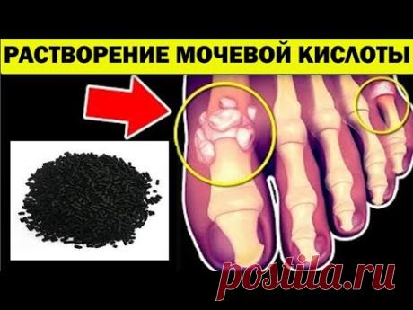 Как растворить Кристаллы Мочевой Кислоты и Соль из Суставов и избежать Подагры