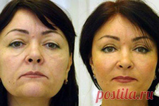 (55) Одноклассники