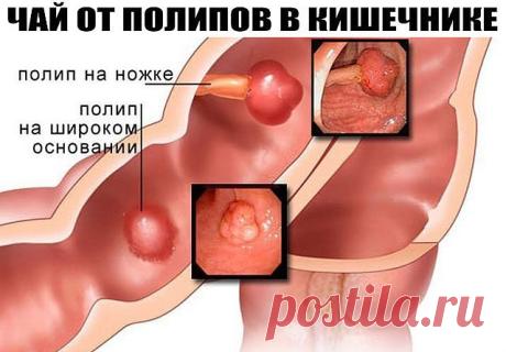 (1) Одноклассники