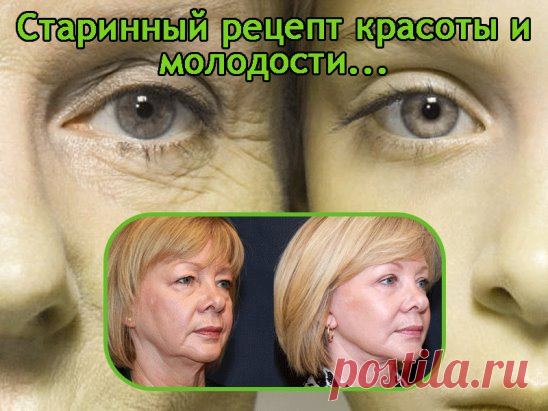 Как я омолодила лицо за 1 месяц 

Привет всем! Помните, я год назад спрашивала у вас совет - как омолодить лицо? Так вот, перепробовала я все ваши чаи, настои, косметические процедуры и так далее – это все ерунда и выкачивание денег. Кожа как была с морщинками, так и осталась.
