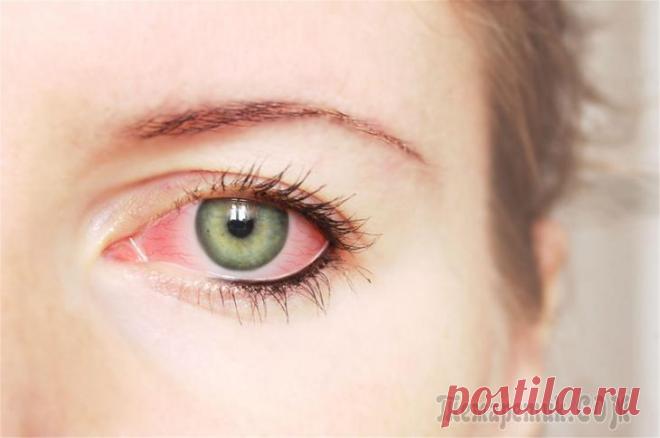 Причин кровоизлияний в глазах Глаз человека ежедневно испытывает значительные нагрузки. Дабы зрение оставалось острым в течение долгих лет, необходимо, чтобы ткани глаза снабжались достаточным количеством кислорода и питательных в...