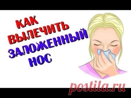 Как вылечить заложенный нос. Ринит