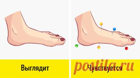 7 неочевидных симптомов, говорящих о том, что у вас нарушено кровообращение