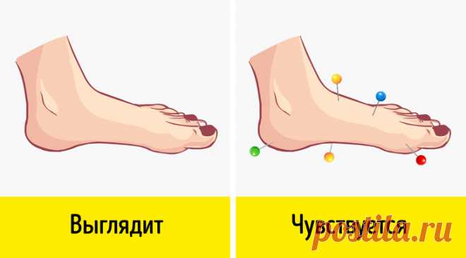 7 неочевидных симптомов, говорящих о том, что у вас нарушено кровообращение