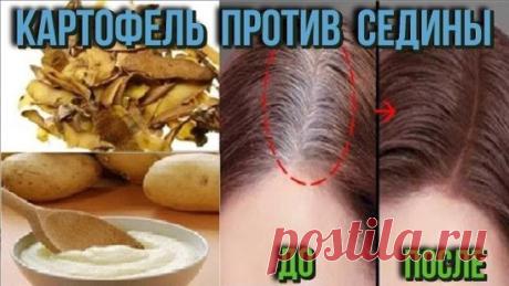 Чтобы седина не портила всю картину, возьми обычный картофель …
Картофель — не только наш второй хлеб, но и лечебный корнеплод, способный творить чудеса с организмом. Сырые плоды давно прославились среди почитательниц натуральных средств по уходу за кожей лица, но на сей раз мы  поделится удивительной методикой, как применять картофель в борьбе с сединой. 
Далеко не всем седина к лицу. И как назло серебряные нити так и норовят проявить себя во всей красе. Проблему вполне может решить покраска в
