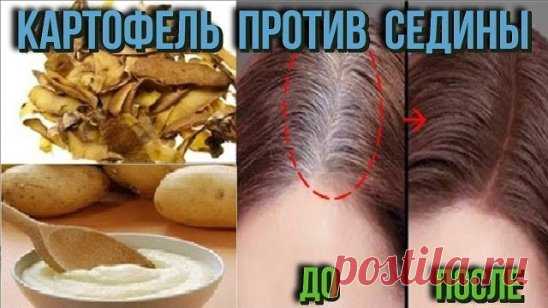 Чтобы седина не портила всю картину, возьми обычный картофель …
Картофель — не только наш второй хлеб, но и лечебный корнеплод, способный творить чудеса с организмом. Сырые плоды давно прославились среди почитательниц натуральных средств по уходу за кожей лица, но на сей раз мы  поделится удивительной методикой, как применять картофель в борьбе с сединой. 
Далеко не всем седина к лицу. И как назло серебряные нити так и норовят проявить себя во всей красе. Проблему вполне может решить покраска в