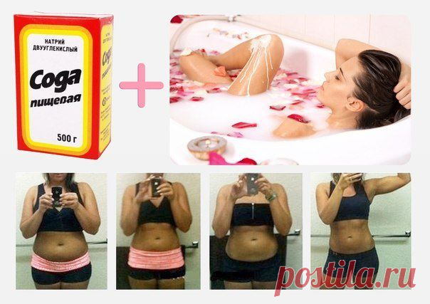 Содовые ванны