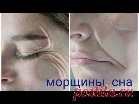 Морщины сна. Как убрать морщины после сна?
