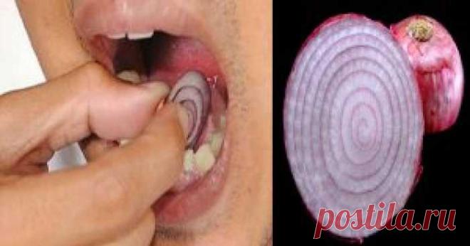Положите кусочек черного лука на зуб и оставьте на 15 минут. Вот, что произойдет! — Домашний уют