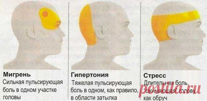 Почему болит голова в затылочной части головы? | Всегда в форме!