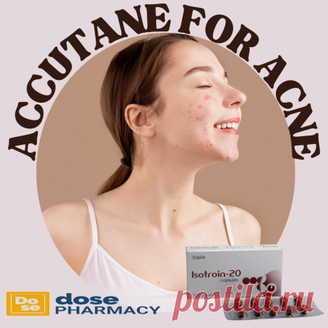 Accutane tablets, also known by their generic name isotretinoin, are a potent medication used to treat severe or persistent acne. They work by reducing oil production, preventing clogged pores, and decreasing inflammation in the skin. While highly effective, Accutane tablets come with potential side effects, including dry skin, lips, and eyes, and require close monitoring by a healthcare professional due to their potency. Additionally, strict contraception measures are necessary for those of chi