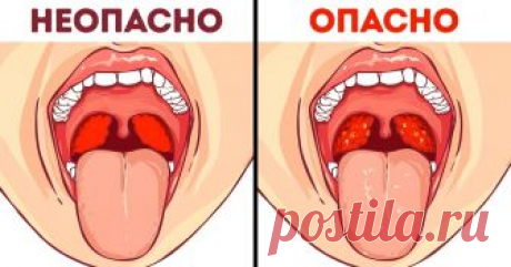 9 «опасных» симптомов, которых на самом деле не стоит бояться (Спойлер: с болью в груди не все так просто) Есть люди, которые относятся к своему здоровью с особенной заботой. К сожалению, под заботой имеется в виду не только правильное питание и полезные физические нагрузки, но и чрезмерная мнительность и привычка выискивать у себя симптомы опасных болезней. Ипохондрия — довольно распространенная проблема в современном мире. Еще более массовой делает ее интернет, где можно...