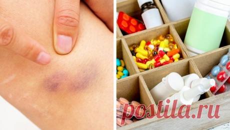 Проблемы, о которых могут сообщать беспричинные синяки на теле - Журнал Советов Как быть, если синяки на коже появляются без причины, какова природа этого явления и стоит ли волноваться? Мы собрали мнения врачей о том, что именно может происходить в организме, если на коже часто появляются синяки. Обратите внимание и проконсультируйтесь со специалистом. Врач, который занимается такими вопросами, называется гематолог. Если синяки появляются, значит, капилляры сильно истончены. […]