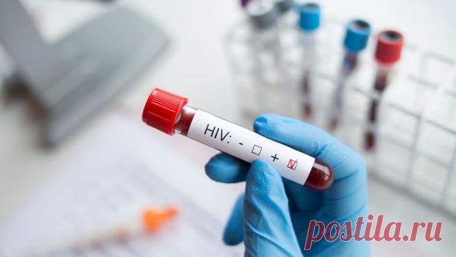 Эпидемиолог рассказал, что каждый сотый россиянин заражен ВИЧ-инфекцией. Каждый сотый гражданин России заражен ВИЧ-инфекцией. Об этом сообщил заведующий специализированным научно-исследовательским отделом по профилактике и борьбе со СПИДом ЦНИИ эпидемиологии Роспотребнадзора академик РАН Вадим Покровский на ...