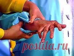 Подагра (наросты на костях).