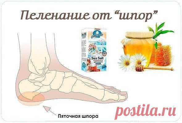 Рецепт, как справиться с пяточными шпорами.