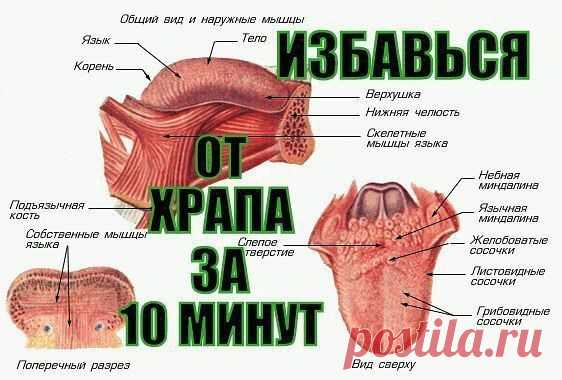 Как за 10 минут ИЗБАВИТЬСЯ ОТ ХРАПА НАДОЛГО!