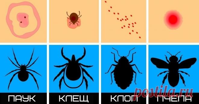 15 видов укусов, которые важно вовремя распознать С приходом тепла просыпается всё живое. И некоторые экземпляры для нас малоприятны. Чего стоят надоедливые комары или незаметные, но опасные клещи. Множество насекомых и других созданий питаются нашей кровью. Есть и такие, что кусают людей, чувствуя угрозу. Как же понять, кто вас укусил, придя из лесу? Для этого нужно знать все виды укусов.