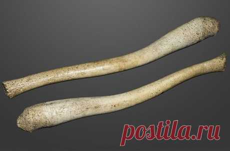 Ученые выяснили, почему мужчины потеряли кость в пенисе / Моя Планета