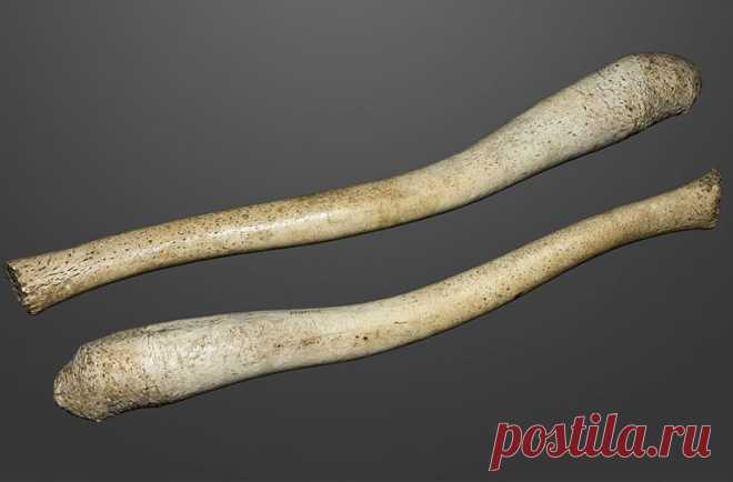 Ученые выяснили, почему мужчины потеряли кость в пенисе / Моя Планета