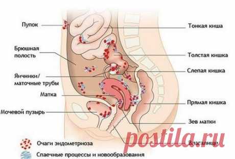 Болезни кишечника – диагностика, симптомы и лечение | Нетгастриту | Яндекс Дзен