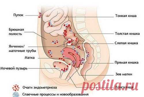 Болезни кишечника – диагностика, симптомы и лечение | Нетгастриту | Яндекс Дзен