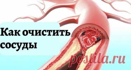 ОЧИЩЕНИЕ СОСУДОВ. ЛУЧШИЕ МЕТОДИКИ
Очищая артерии и вены нашего организма от отложений солей и всевозможных осадков, мы возвращаем им эластичность, гибкость, а также делаем их молодыми. В результате очищения излечиваются сосудистые заболевания, уменьшаются варикозные вены, улучшаются слух и зрение, исчезают головные боли, склероз, вероятность инфаркта. Улучшается состояние желудочно-кишечного тракта, легких, бронхов, придаточных пазух носа и носоглотки.