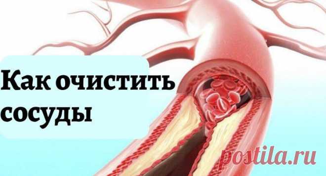 ОЧИЩЕНИЕ СОСУДОВ. ЛУЧШИЕ МЕТОДИКИ
Очищая артерии и вены нашего организма от отложений солей и всевозможных осадков, мы возвращаем им эластичность, гибкость, а также делаем их молодыми. В результате очищения излечиваются сосудистые заболевания, уменьшаются варикозные вены, улучшаются слух и зрение, исчезают головные боли, склероз, вероятность инфаркта. Улучшается состояние желудочно-кишечного тракта, легких, бронхов, придаточных пазух носа и носоглотки.