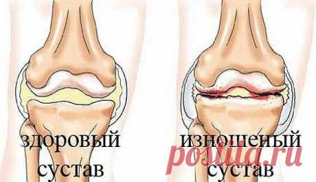 Отличный рецепт от боли в суставах

Простейший народный рецепт для лечения суставов.
(не смотрите, что простой, очень много отзывов об эффективности этого рецепта!)

Наверняка многие не по наслышке знают, что такое боли в суставах. Какой, мягко скажем, дискомфорт доставляют они человеку.
А народный рецепт лечения суставов необычайно прост, к тому же безопасен.

1 ч. ложку пищевого желатина заливаем остывшей кипяченой водой (0,5 стакана) и оставляем на ночь.

Утром доводим ...