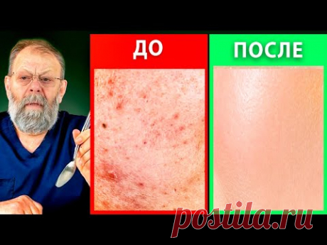 СОЛЬ И ВОДА — СЕКРЕТ ИДЕАЛЬНОЙ КОЖИ И ЗДОРОВОЙ ЖЕЛЧИ